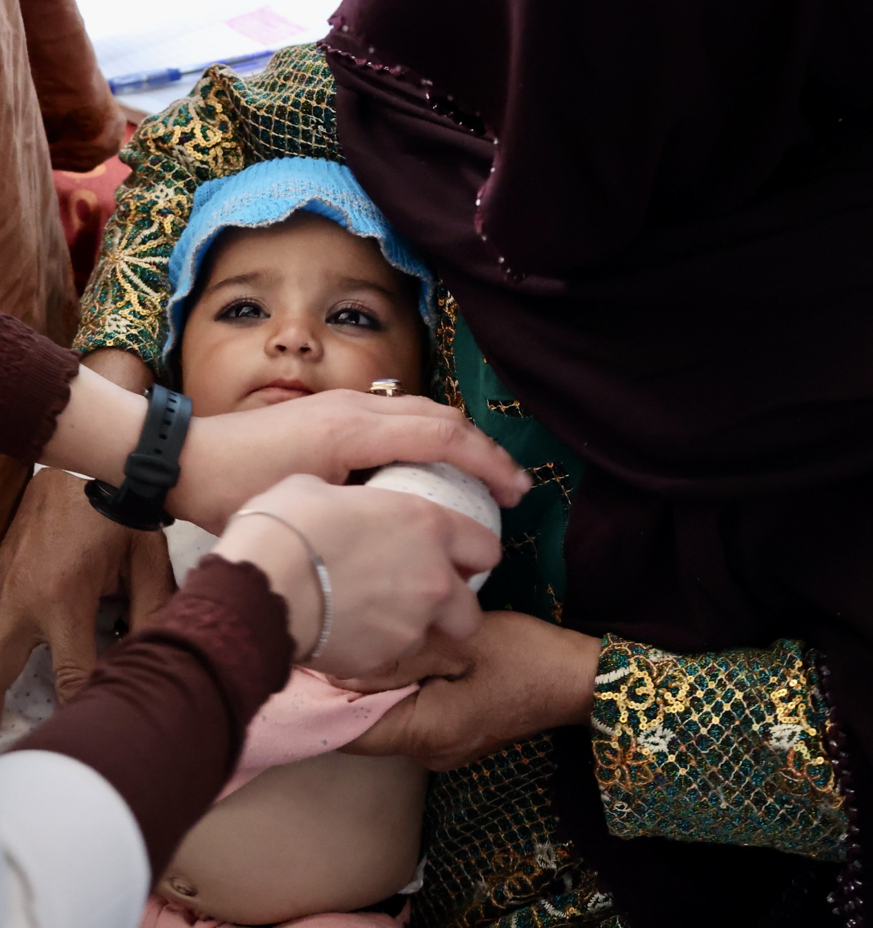 A baby girl is hold by her mother while checked by a doctor